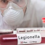 Legionella Testing, Risk Management & Compliance | Green Water Services